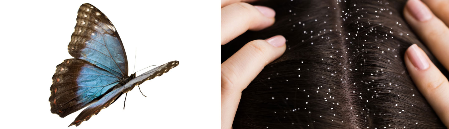A butterfly and a clean fresh scalp hairline
